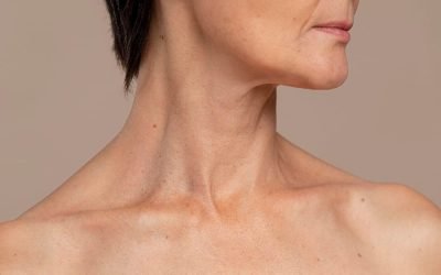 neck-lift-surgery
